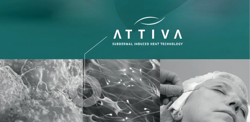 アッティバの施術イメージ