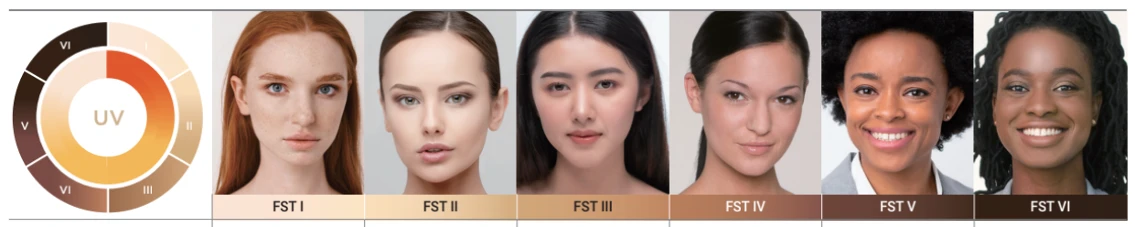 ヘリオス785 - スキンタイプ