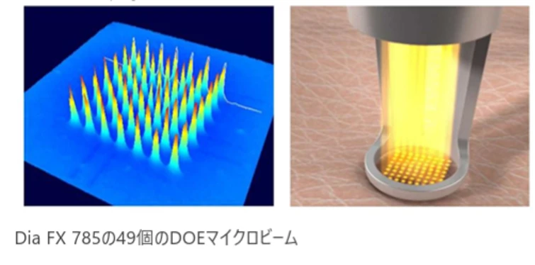 ヘリオス785 - Dia FX 785の48個のDOEマイクロビーム