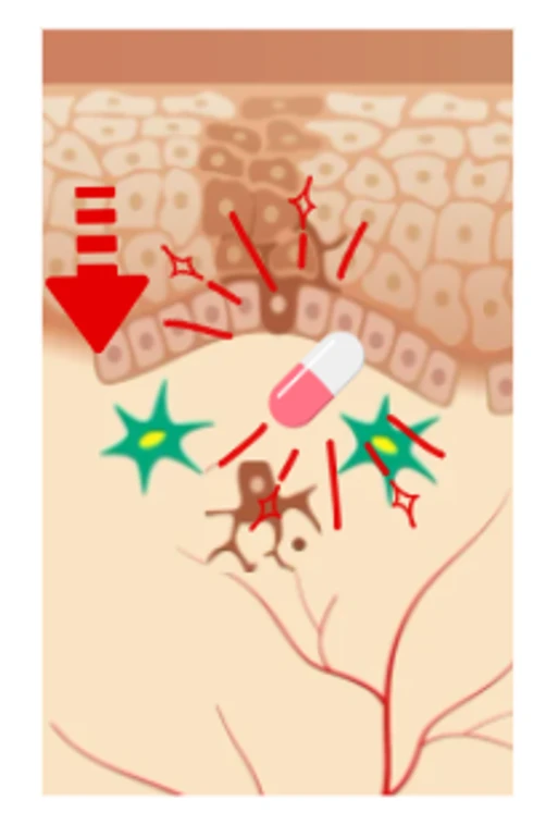 肝斑での内服治療（トラネキサム酸など）による表皮付近のイラスト