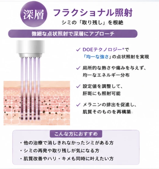 ヘリオス785:深層 フラクショナル照射