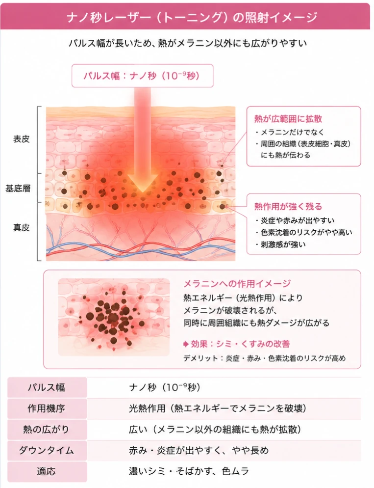 ヘリオス785:ナノ秒レーザー(トーニング)の照射イメージ