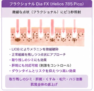 ヘリオス785:フラクショナルDia FX(Helios 785 Pico)