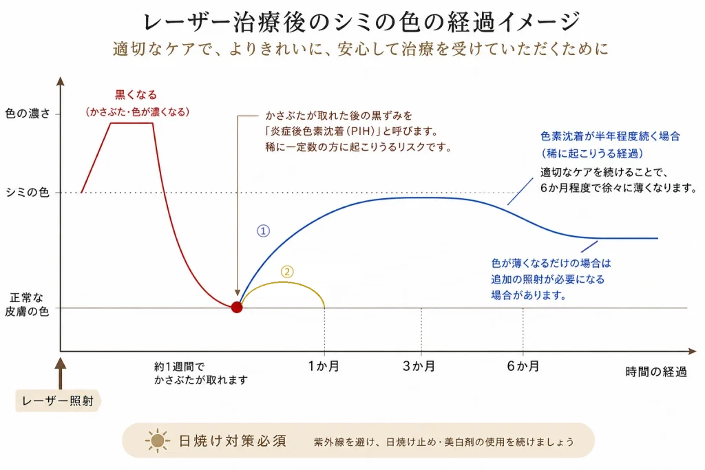 レーザー治療後のシミの色の経過イメージ