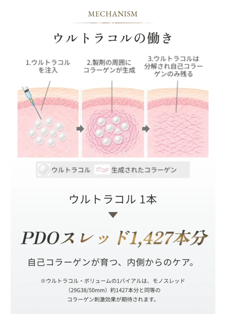 ウルトラコルの働き 1. ウルトラコルを注入、2. 製剤の周辺にコラーゲンが生成、3. ウルトラコルは分解され自己コラーゲンのみ残る