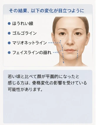 ほうれい線、ゴルゴライン、マリオネットライン、フェイスラインの崩れが目立つように