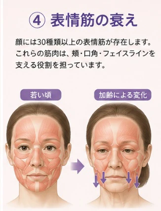 4. 表情筋の衰え
