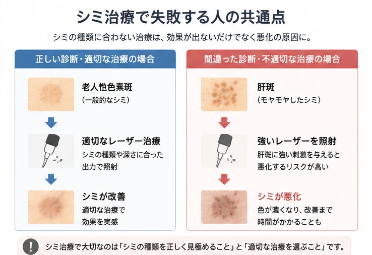 シミ治療で失敗する人の共通点