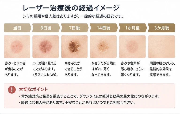 レーザー治療後の経過イメージ