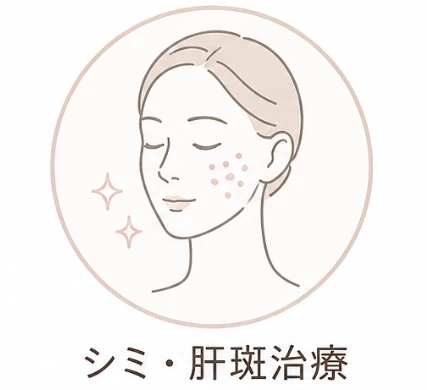 シミ・肝斑治療