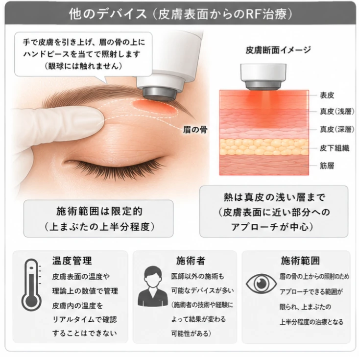 他のデバイス（皮膚表面からのRF治療）