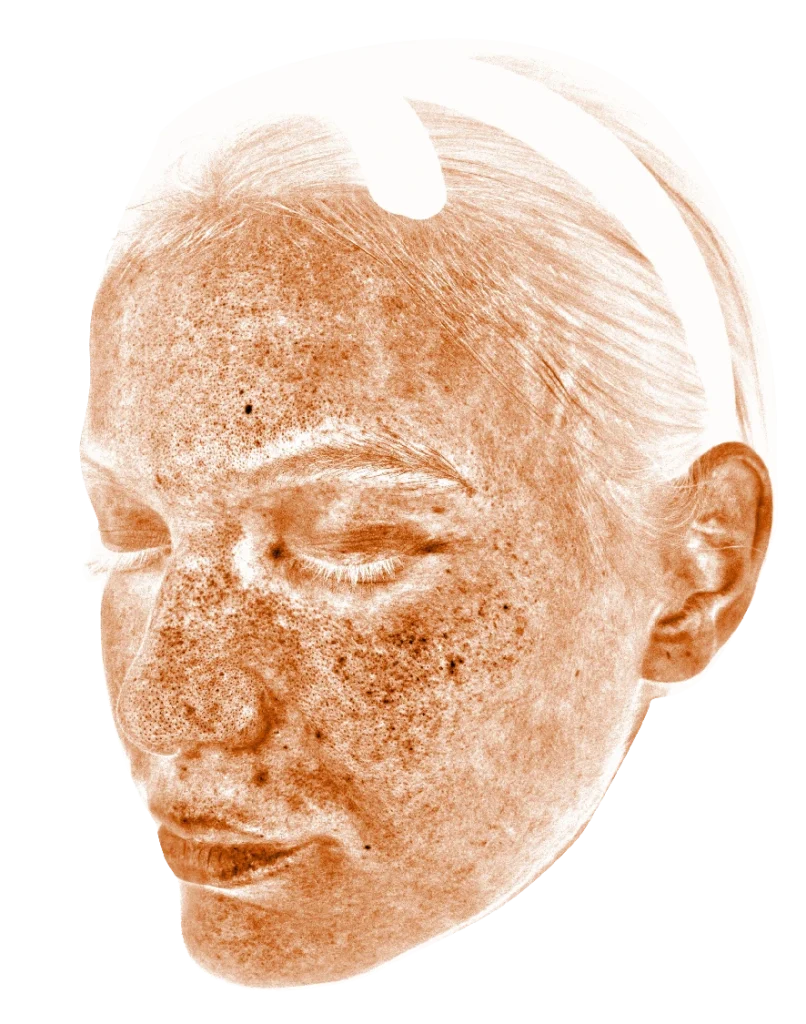 肌診断メイセットの診断画像1