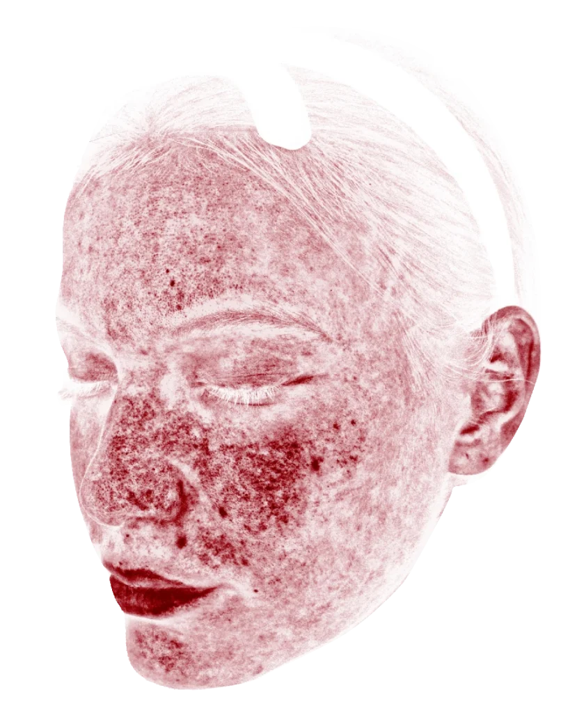 肌診断メイセットの診断画像2