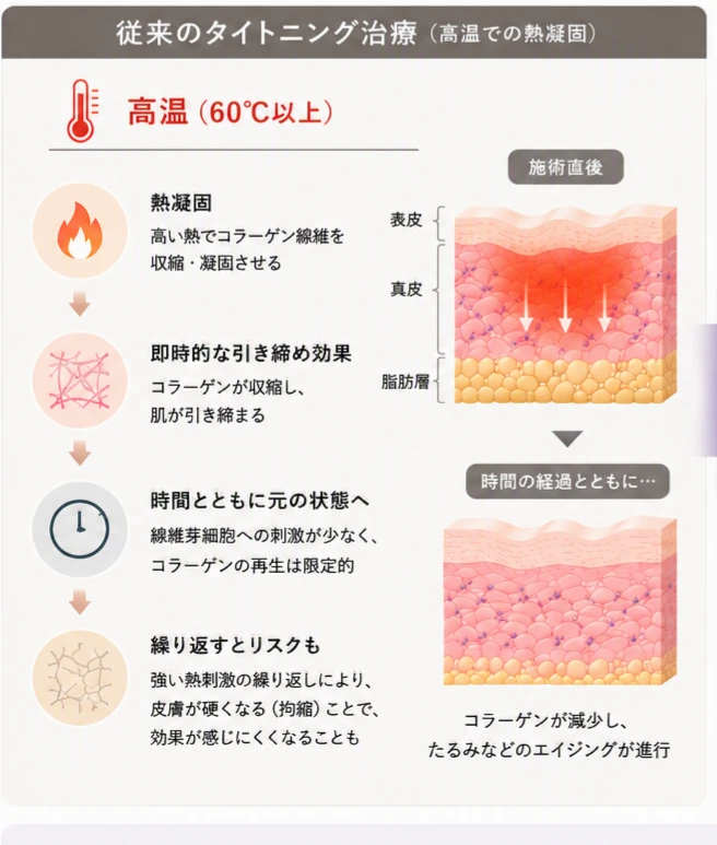 従来のタイトニング治療（高温での熱凝固）