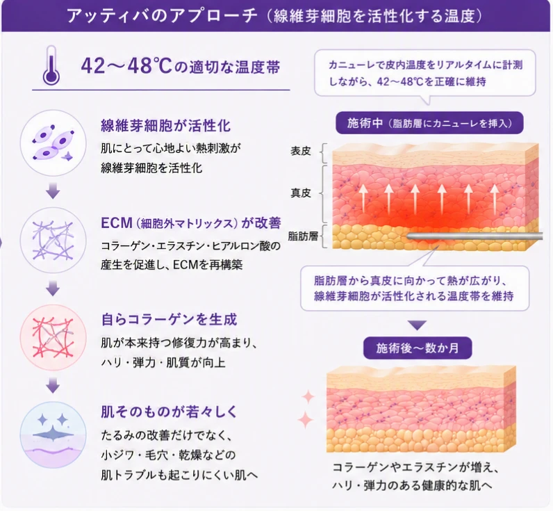 アッティバのアプローチ（線維芽細胞を活性化する温度）