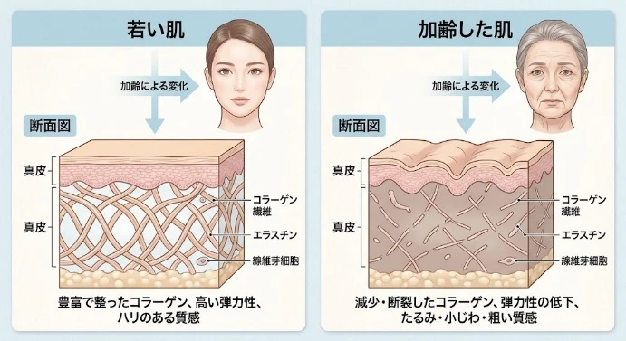 若い肌と加齢した肌の断面図