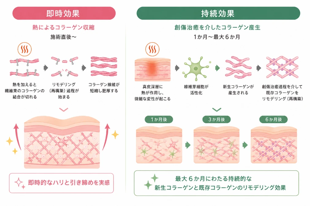 即時効果と持続効果