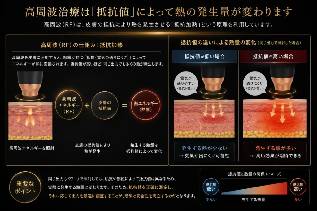 高周波治療は抵抗値によって熱の発生量が変わります